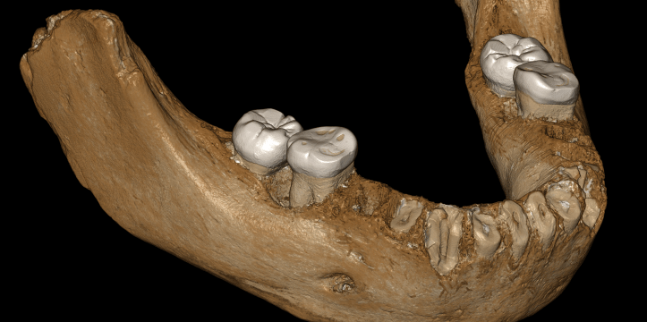 Onderkaak Denisova-mens