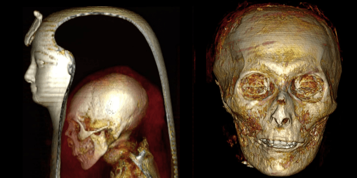 Mummie CT scan