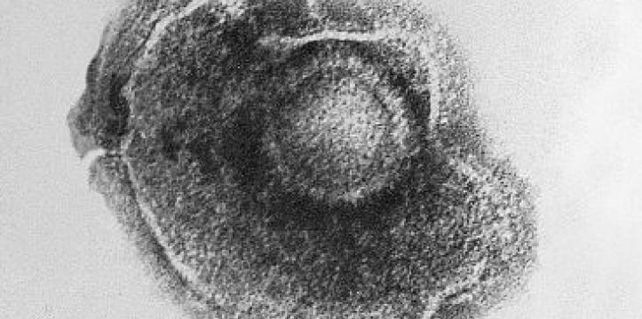 Virus Siberië