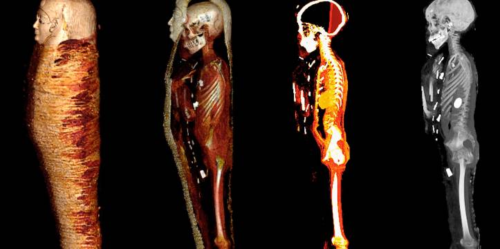 Wetenschappers hebben een Egyptische mummie met een CT-scan 'digitaal uitgepakt'