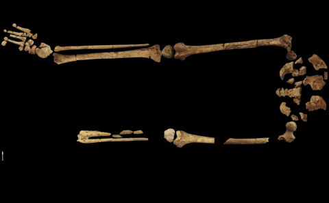 Het skelet vanaf de heupen naar beneden, inclusief de missende linkervoet