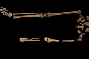 Het skelet vanaf de heupen naar beneden, inclusief de missende linkervoet