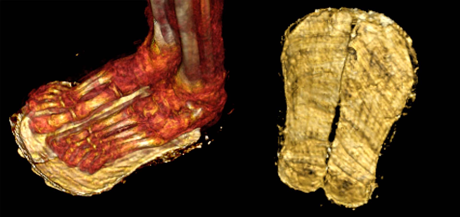 Bij de CT-scan bleek dat de tienerjongen met sandalen aan was gemummificeerd