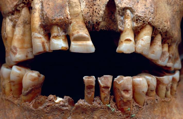 Volgens de studie waren de mannen met gevijlde tanden handelaars