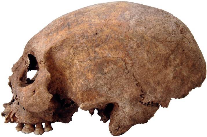 Volgens de onderzoekers was het gebruik om schedels op te rekken naar Gotland overgekomen vanuit Zuidoost-Europa